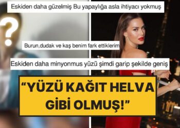 Fahriye Evcen’in Yıllar Önceki Görüntüleri “Estetik” Tartışmasını Tekrar Alevlendirdi