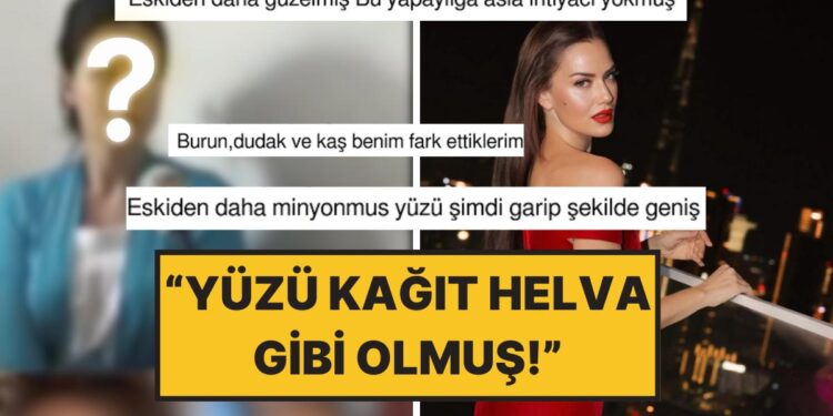 Fahriye Evcen’in Yıllar Önceki Görüntüleri “Estetik” Tartışmasını Tekrar Alevlendirdi