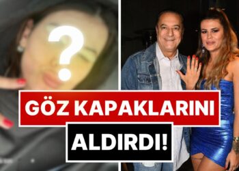 Muradına Erdi: Mehmet Ali Erbil’İn Kendisinden 40 Yaş Küçük Eşi Gülseren Ceylan Estetik Yaptırdı!