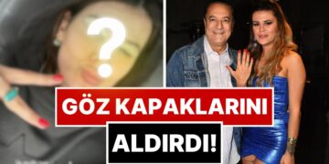 Muradına Erdi: Mehmet Ali Erbil’İn Kendisinden 40 Yaş Küçük Eşi Gülseren Ceylan Estetik Yaptırdı!