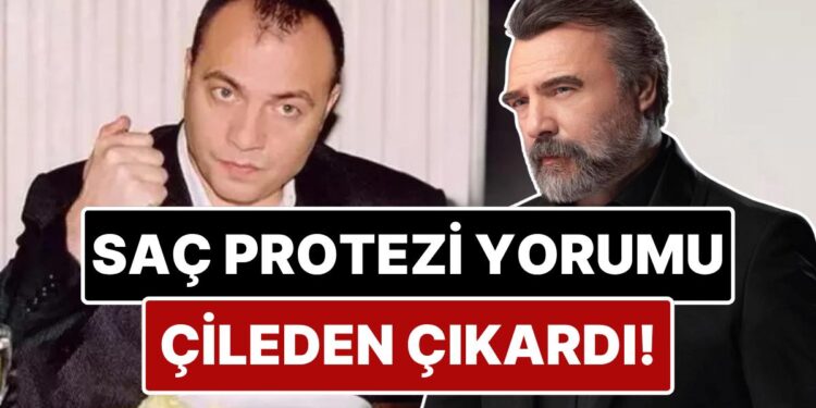 Oktay Kaynarca’dan Saçının Protez Olduğunu İddia Eden Kullanıcıya Ağır Cevap!