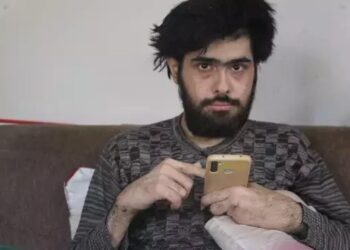 Türkiye’nin konuştuğu ve 3 yıldır tırnaklarını kesmeyen gencin eski hali ortaya çıktı