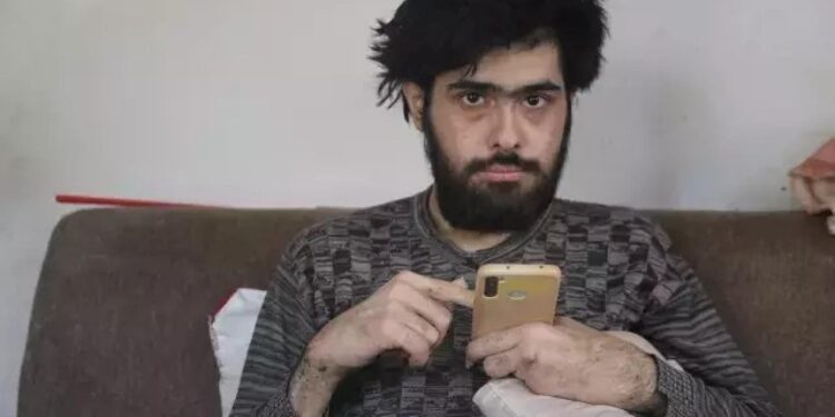 Türkiye’nin konuştuğu ve 3 yıldır tırnaklarını kesmeyen gencin eski hali ortaya çıktı