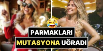 Yapay Zekadan Yararlanmaya Çalışan Gülben Ergen’in Mutasyona Uğrayan Parmakları Gözlerden Kaçmadı!