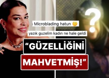 Yeşilçam’ın Usta İsmi Selma Güneri’nin Son Hali Botoks Tartışmalarını Alevlendirdi