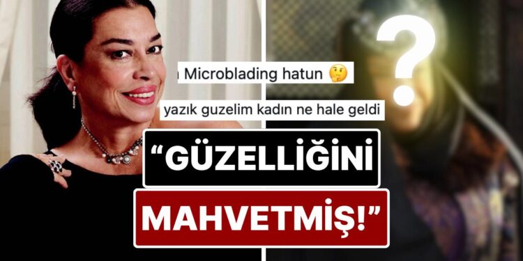 Yeşilçam’ın Usta İsmi Selma Güneri’nin Son Hali Botoks Tartışmalarını Alevlendirdi