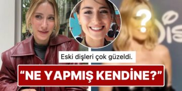 Yüzündeki Değişiklikle Son Hali Dikkat Çeken Hazal Kaya’nın Dişlerine Yaptırdığı İşlem Sınıfta Kaldı