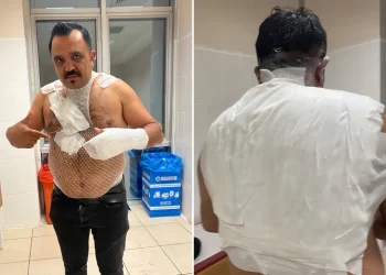 Deney yapmak isterken hayatının hatasını yaptı