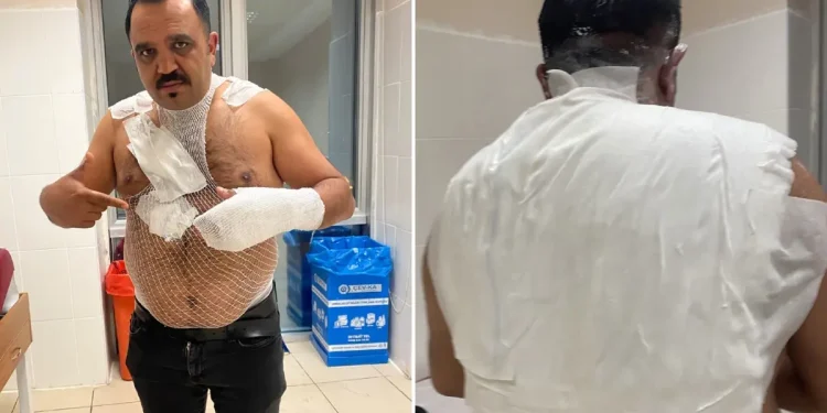 Deney yapmak isterken hayatının hatasını yaptı