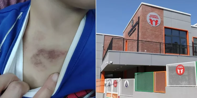 Kreşte Taciz İddiası: Mağdur Çocuk Şok İfadesini Verdi