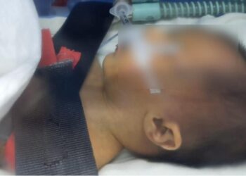 Özel hastanede korkunç olay! Düşürüp kafatasını kırdıkları Ahsen bebek hayatını kaybetti