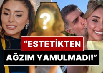 Samar Dadgar’dan “Estetik” Yorumlarına Net Yanıt: “Estetiğim Yok, Diş Doktoru Yüzünden”