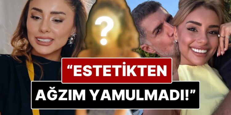Samar Dadgar’dan “Estetik” Yorumlarına Net Yanıt: “Estetiğim Yok, Diş Doktoru Yüzünden”