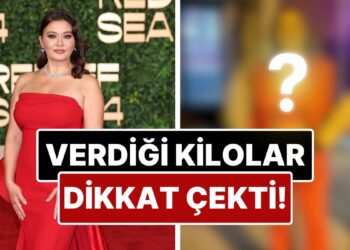Son Halini Paylaşan Nurgül Yeşilçay’ın Verdiği Kilolar Dikkat Çekti!