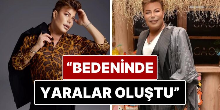 Yaklaşık 2 Aydır Yoğun Bakımda Tedavi Gören Fatih Ürek’in Bedeninde Yaralar Oluştu