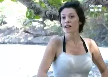 Didem Ceran yüz nakliyle bambaşka görünüyor