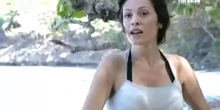 Didem Ceran yüz nakliyle bambaşka görünüyor