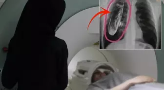 Doktorların “canlı böcek” dediği hastada şok gerçek