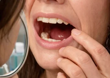 Dişleri Bir Anda Kaybolan Kişi Hastanede Şok Etti