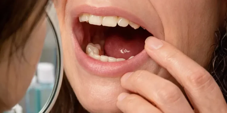 Dişleri Bir Anda Kaybolan Kişi Hastanede Şok Etti