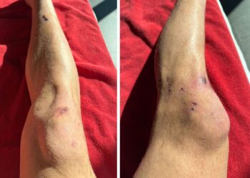 Tarihi Zaferin Bedeli Dün Gece Ortaya Çıktı