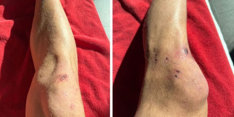 Tarihi Zaferin Bedeli Dün Gece Ortaya Çıktı