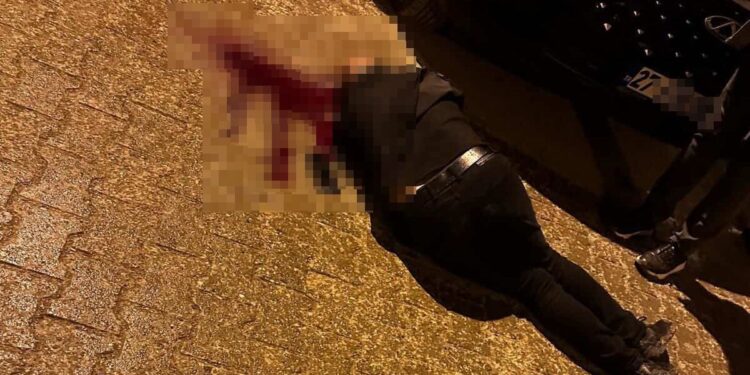 Yolda Yürürken Tabanca ile Başından Yaralandı